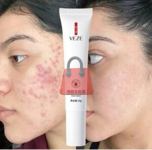 Crema antiacné VEZE.