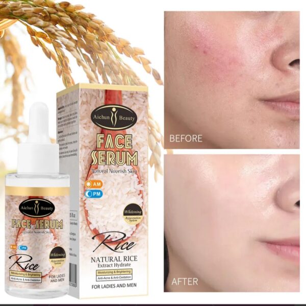 Serum Facial de Arroz