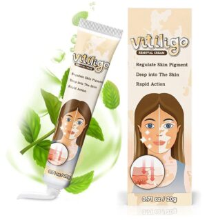 Tratamiento de vitíligo, crema para el cuidado del vitíligo de la piel.